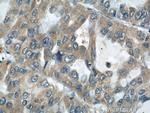 AARS2 Antibody in Immunohistochemistry (Paraffin) (IHC (P))
