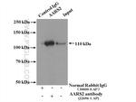 AARS2 Antibody in Immunoprecipitation (IP)