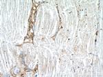 DOK7 Antibody in Immunohistochemistry (Paraffin) (IHC (P))