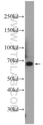 DOK7 Antibody in Western Blot (WB)