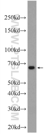 DOK7 Antibody in Western Blot (WB)