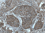 EML4 Antibody in Immunohistochemistry (Paraffin) (IHC (P))