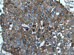 EML4 Antibody in Immunohistochemistry (Paraffin) (IHC (P))