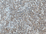 EML4 Antibody in Immunohistochemistry (Paraffin) (IHC (P))