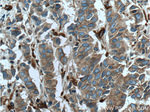 EML4 Antibody in Immunohistochemistry (Paraffin) (IHC (P))