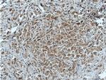 EML4 Antibody in Immunohistochemistry (Paraffin) (IHC (P))
