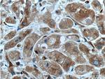 EML4 Antibody in Immunohistochemistry (Paraffin) (IHC (P))