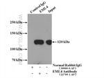 EML4 Antibody in Immunoprecipitation (IP)