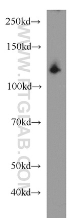 EML4 Antibody in Western Blot (WB)