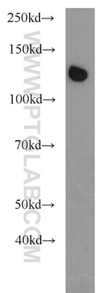 EML4 Antibody in Western Blot (WB)
