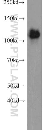 EML4 Antibody in Western Blot (WB)