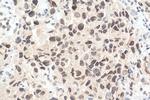 WHSC1 Antibody in Immunohistochemistry (Paraffin) (IHC (P))