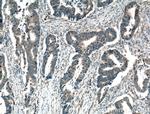 ARK5 Antibody in Immunohistochemistry (Paraffin) (IHC (P))