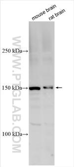 CHD5 Antibody in Western Blot (WB)