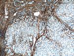 Collagen Type III (N-terminal) Antibody in Immunohistochemistry (Paraffin) (IHC (P))
