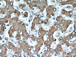 RWDD3 Antibody in Immunohistochemistry (Paraffin) (IHC (P))