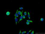 GDEP Antibody in Immunocytochemistry (ICC/IF)