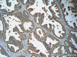 GDEP Antibody in Immunohistochemistry (Paraffin) (IHC (P))