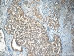 GDEP Antibody in Immunohistochemistry (Paraffin) (IHC (P))