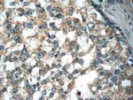 GDEP Antibody in Immunohistochemistry (Paraffin) (IHC (P))
