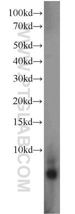 GDEP Antibody in Western Blot (WB)