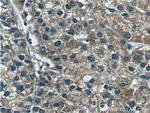 SARDH Antibody in Immunohistochemistry (Paraffin) (IHC (P))