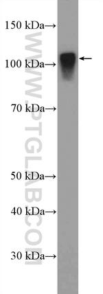 SARDH Antibody in Western Blot (WB)