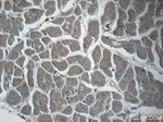 SPRY4 Antibody in Immunohistochemistry (Paraffin) (IHC (P))