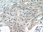 SPRY4 Antibody in Immunohistochemistry (Paraffin) (IHC (P))