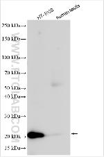 NOP10 Antibody in Western Blot (WB)