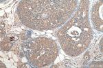 CCDC64B Antibody in Immunohistochemistry (Paraffin) (IHC (P))