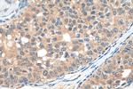 CCDC64B Antibody in Immunohistochemistry (Paraffin) (IHC (P))
