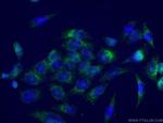 LIFR Antibody in Immunocytochemistry (ICC/IF)