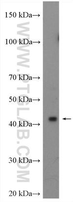 TWISTNB Antibody in Western Blot (WB)