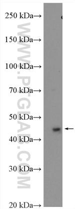 TWISTNB Antibody in Western Blot (WB)