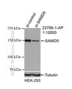 SAMD9 Antibody in Western Blot (WB)