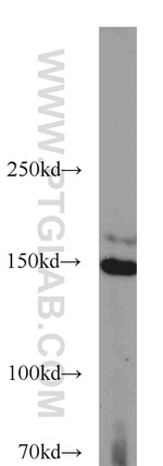 SAMD9 Antibody in Western Blot (WB)