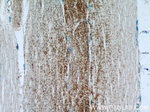 MCT4 Antibody in Immunohistochemistry (Paraffin) (IHC (P))