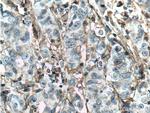 MCT4 Antibody in Immunohistochemistry (Paraffin) (IHC (P))