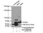 HIC2 Antibody in Immunoprecipitation (IP)