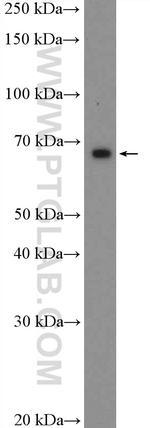 HIC2 Antibody in Western Blot (WB)