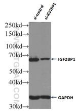 IGF2BP1 Antibody in Western Blot (WB)