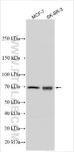 KRT28 Antibody in Western Blot (WB)