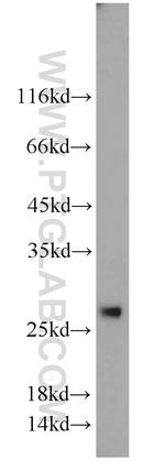 C7orf30 Antibody in Western Blot (WB)