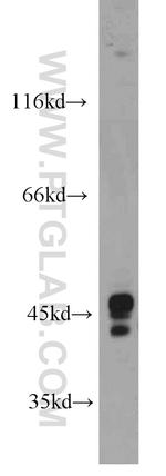 OFD1 Antibody in Western Blot (WB)
