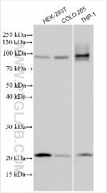 ADAM33 Antibody in Western Blot (WB)