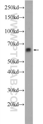 ACSM2A Antibody in Western Blot (WB)