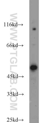 B3GNT7 Antibody in Western Blot (WB)