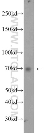 MEX3C Antibody in Western Blot (WB)