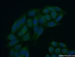 MEX3C Antibody in Immunocytochemistry (ICC/IF)